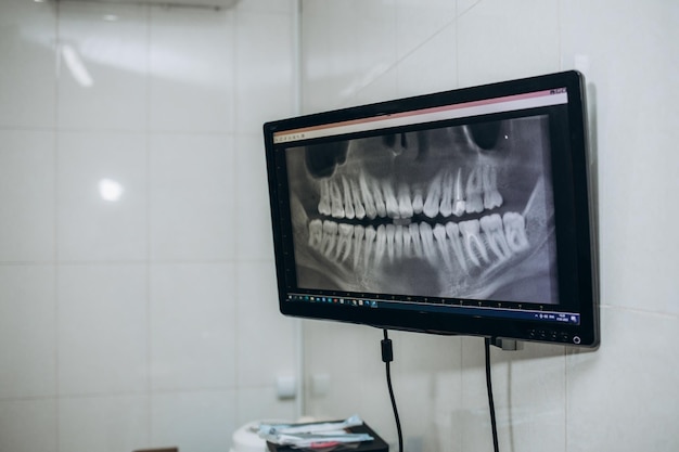 Doctor looking at human teeth xray on computer monitor Modern dental clinic