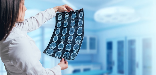 의사 찾고 MRI 사진입니다.