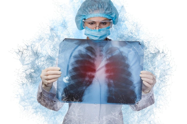 Foto medico che esamina un'istantanea dei polmoni con polmonite su sfondo bianco