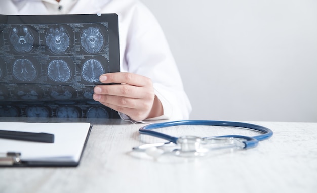 Doctor looking at xray picture of head.