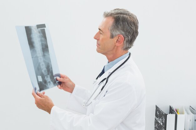 Doctor looking at xray picture of spine in office