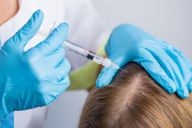 The doctor making mesotherapy injections in woman's head for stronger and healthier hair