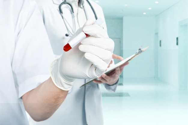 Doctor man with stethoscope holding a clipboard and holding a test tube with a blood sample