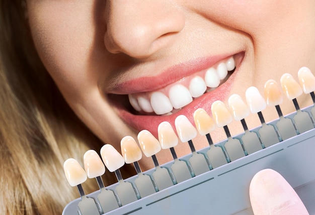 Doctor matching patients teeth color with palette closeup\
cosmetic dentistry