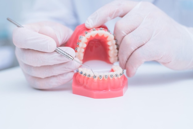 Doctor orthodontist shows how the system of braces on teeth is arranged