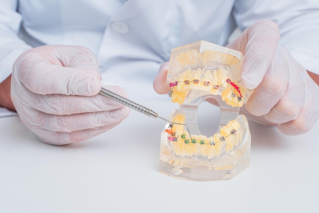 Doctor orthodontist shows how the system of braces on teeth is arranged