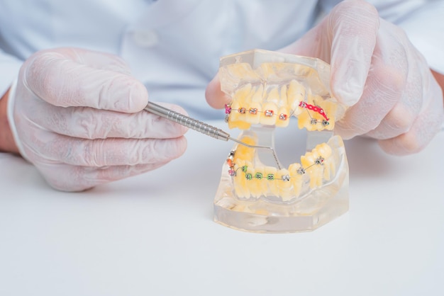 Doctor orthodontist shows how the system of braces on teeth is arranged