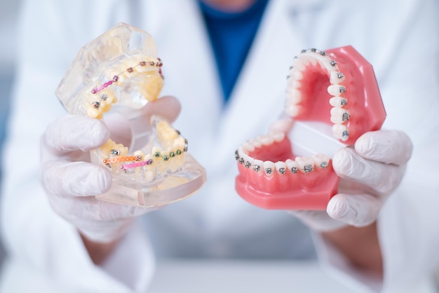 의사 치열 교정 의사는 치아 교정기 시스템이 어떻게 배열되어 있는지 보여줍니다.