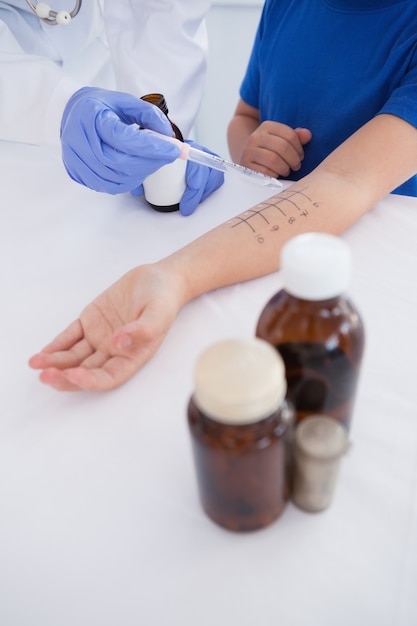 Doctor performing a skin prick test