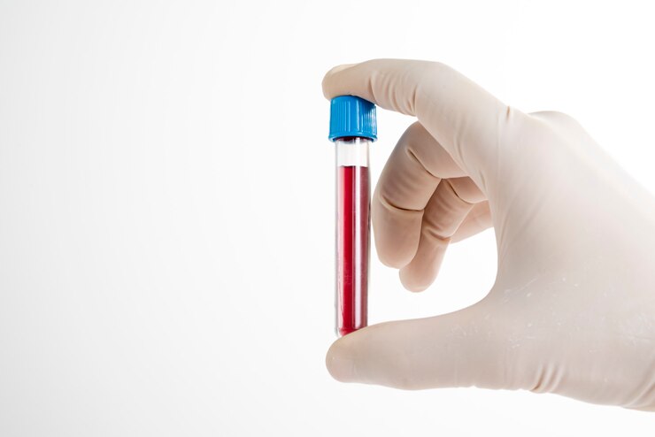 Photo doctor presenting tube with blood for complete blood test.
