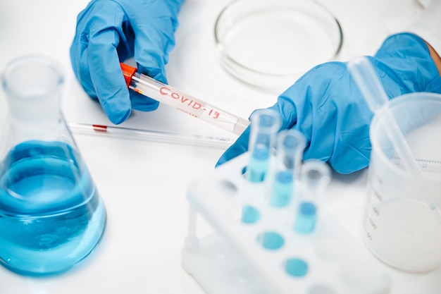 Doctor in protective gloves holding test tube with blue liquid and word covid at table in clinic