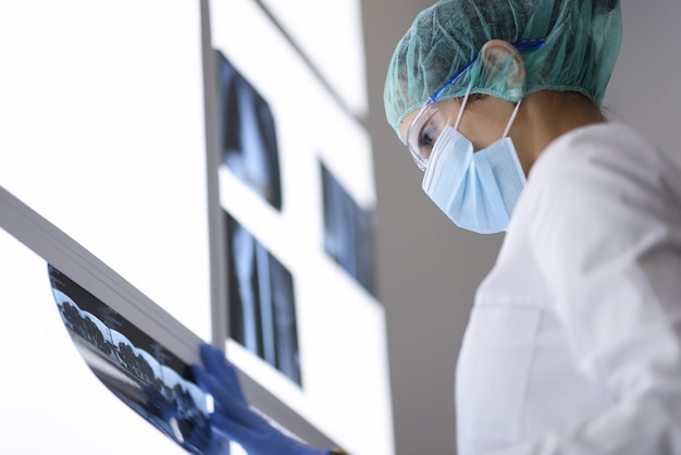 Doctor in protective medical mask and glasses looks at an X-ray