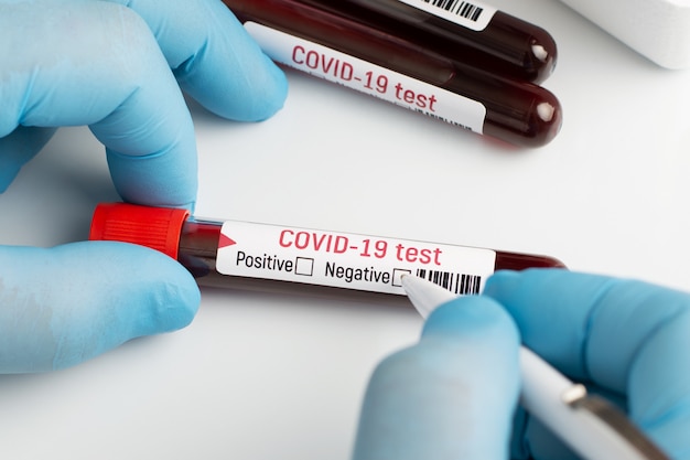 의사는 혈액 샘플에 부정적인 단어 단어 근처에 확인 표시를 넣어 코로나 바이러스에 혈액을 테스트합니다.