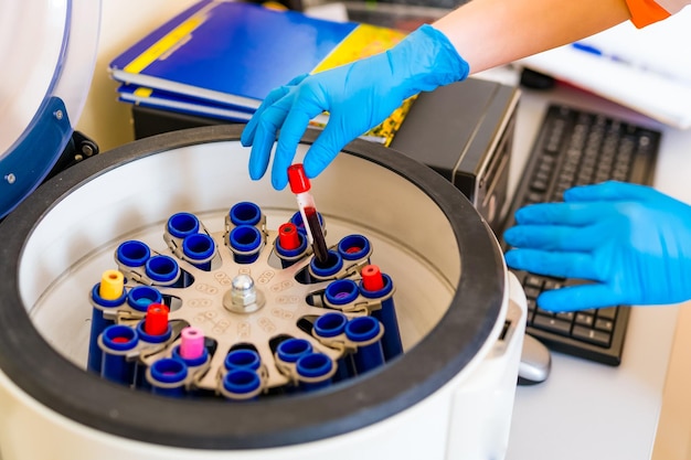 Doctor putting tubes of blood in centrifugal machine for testing and analyzing