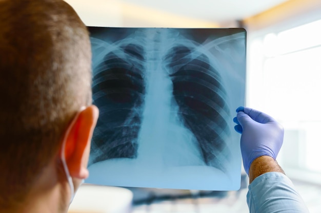 Doctor reading a chest xray in a hospital closeup