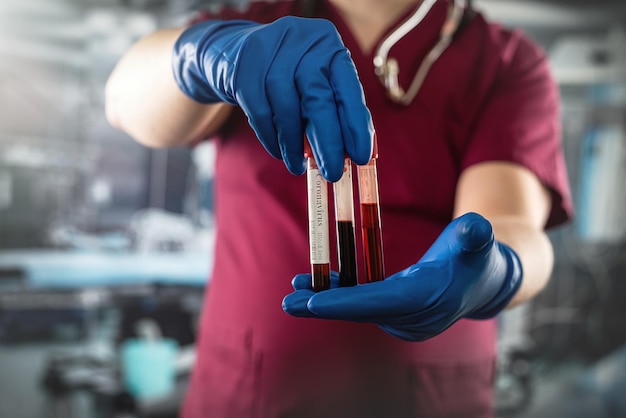 Doctor in red uniform holding blood in test tube for coronavirus in laboratory hospital