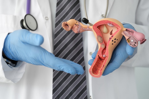 Doctor in rubber gloves holding plastic mock-up of female uterus in clinic closeup. Diseases of female reproductive system concept