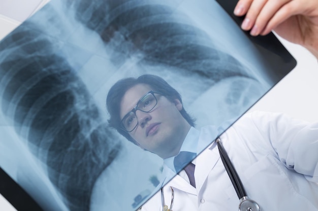 Doctor's face behind xray