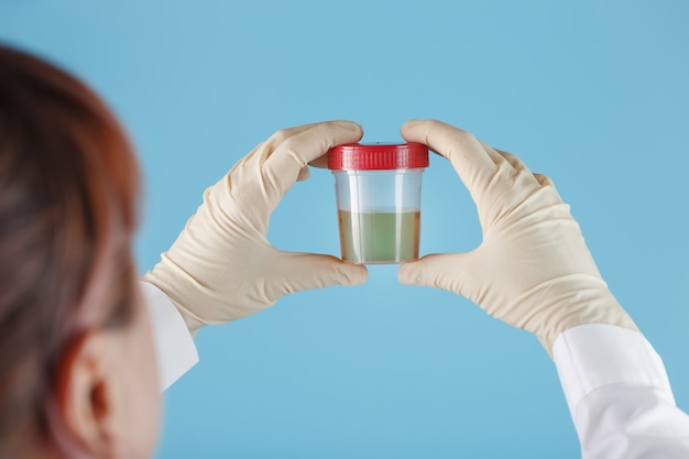 The doctor's gloved hand holds a transparent container with a urine test.