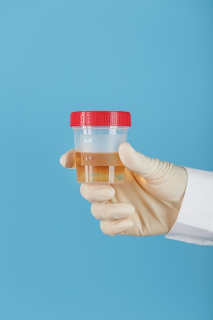 The doctor's gloved hand holds a transparent container