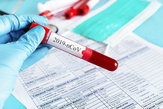 Doctor's hand holding red blood vial with blood sample for coronavirus test