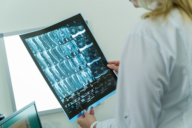 Photo doctor's hands with computer tomography film or x-ray. medical room background.