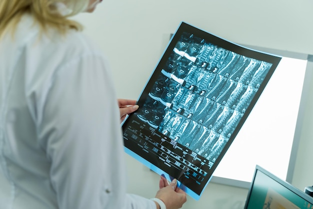 Doctor's hands with computer tomography film or xray Medical room background