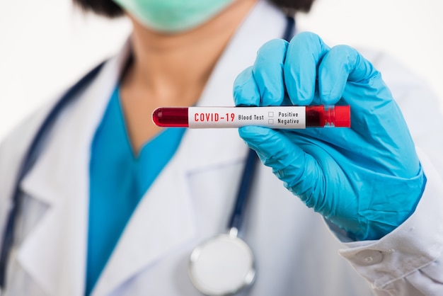 Medico scienziato in uniforme bianca indossa una maschera che tiene il campione di sangue del test del coronavirus del tubo