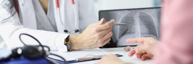 Doctor shows the patient an xray of lungs lung disease symptoms 