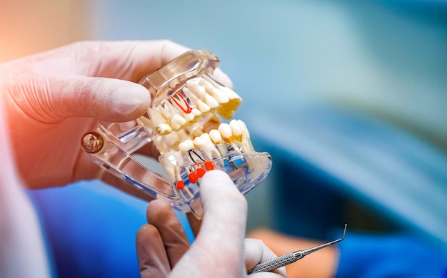 Doctor shows on a plastic jaw sample or model different methods of teeth treatment.