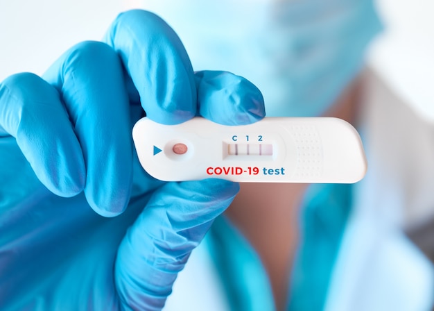 Il medico mostra un rapido test di laboratorio covid-19 per la rilevazione di anticorpi igm e igg contro il nuovo coronavirus, sars-cov-2 con esito positivo. immunità contro covid-19