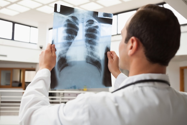 Doctor studying x-ray 