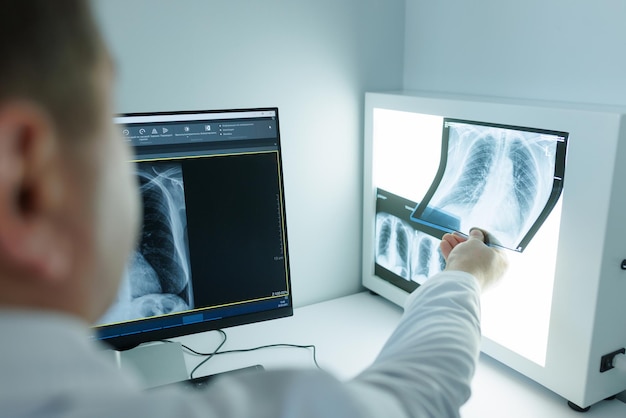 Doctor studying xray on computer