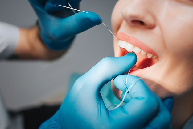 Doctor using floss with a patient for cleaning between teeth