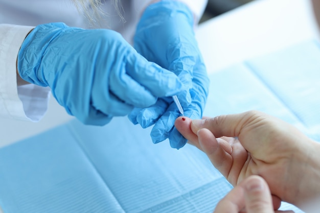 Doctor wearing disposable gloves takes blood from patient finger. Complete blood count concept