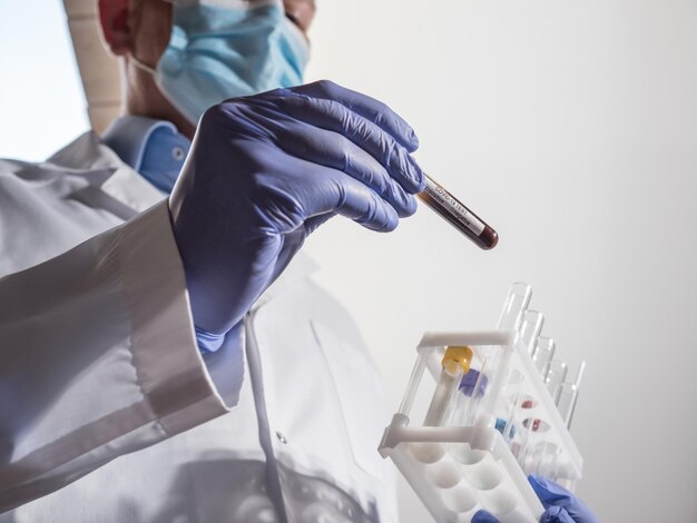 Doctor wearing mask and gloves checks a covid19 analysis test tube