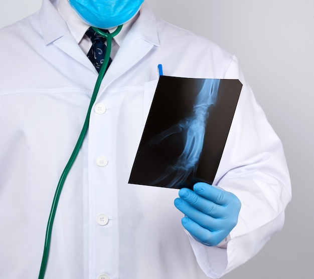 Doctor in a white coat and blue latex gloves holds an x-ray