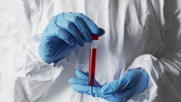 A doctor in a white protective suit and blue disposable gloves examines a blood test of a patient with coronavirus