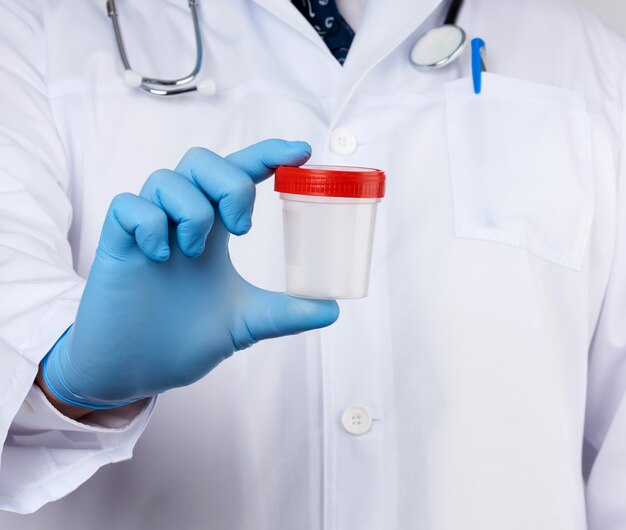 Doctor in white uniform and latex gloves is holding an empty plastic container for taking urine samples