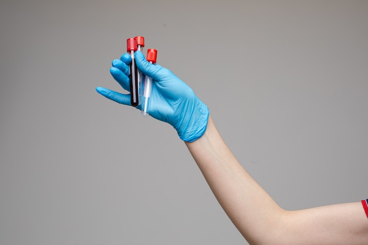 Photo doctor with blood tests in tube.