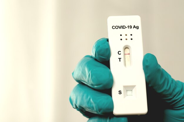 Photo doctor with covid-19 test kit from the lab at the hospital