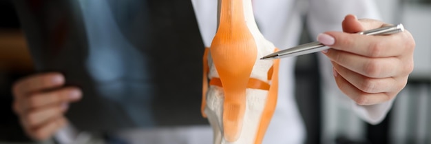 Doctor with xray in his hands showing structure of knee joint on artificial model closeup