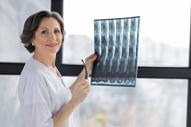 Photo doctor woman holding spine x-ray film of patient standing by the window at hospital