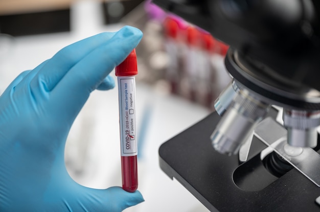 Doctor working with blood sample in laboratory