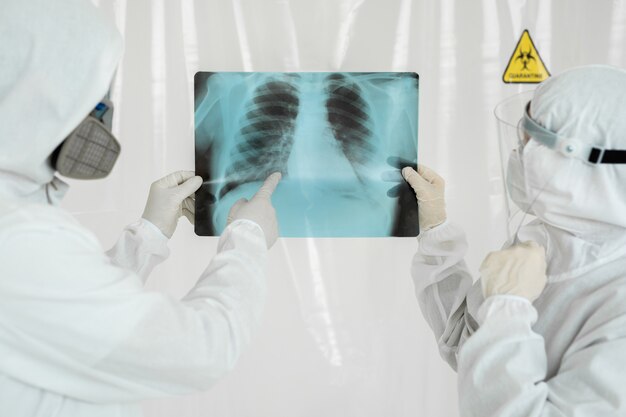 Doctors Epidemiologists examine x-ray for pneumonia of a Covid-19 patient. Coronavirus concept