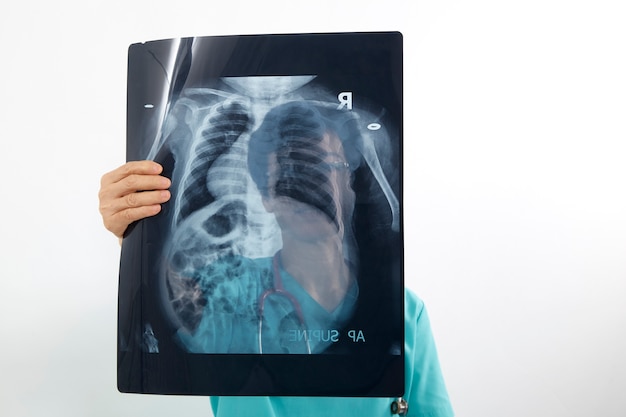 Photo doctors examining x-ray of chest