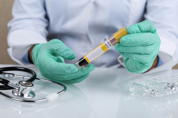 doctors hands hold blood test tube with mock up