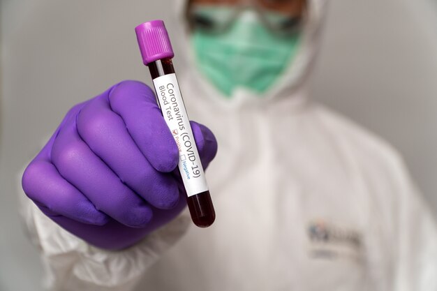 Doctors in the protective suits and masks are holding a positive blood test result for new rapidly outbreaking Coronavirus.