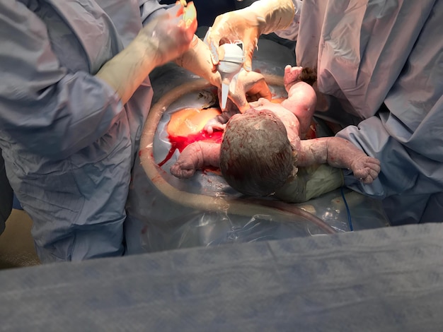 Photo doctors with newborn baby in operating room