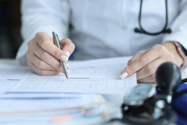 Dokter cardioloog onderzoekt patiënt cardiogram op papier in kliniek close-up